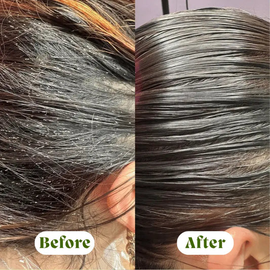 GlideAway™ - Anti Lice & Nits Tonic