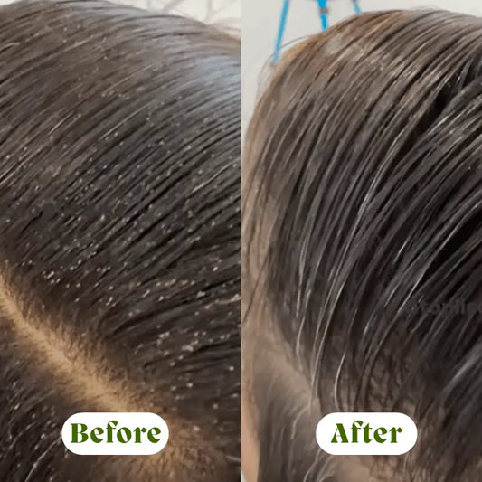 2 x GlideAway™.-.Herbal Anti Lice & Nits Tonic